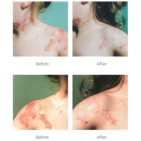 cica-care-examples-of-use